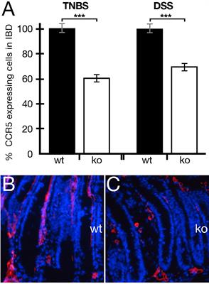 Role of periostin in inflammatory bowel disease development and synergistic effects mediated by the CCL5–CCR5 axis